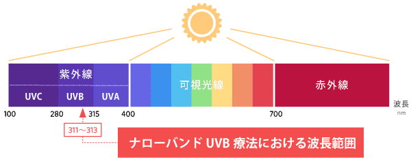 ナローバンドUVB療法における波長範囲