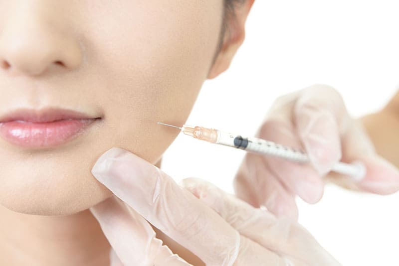 注入（ボトックス・ヒアルロン酸）