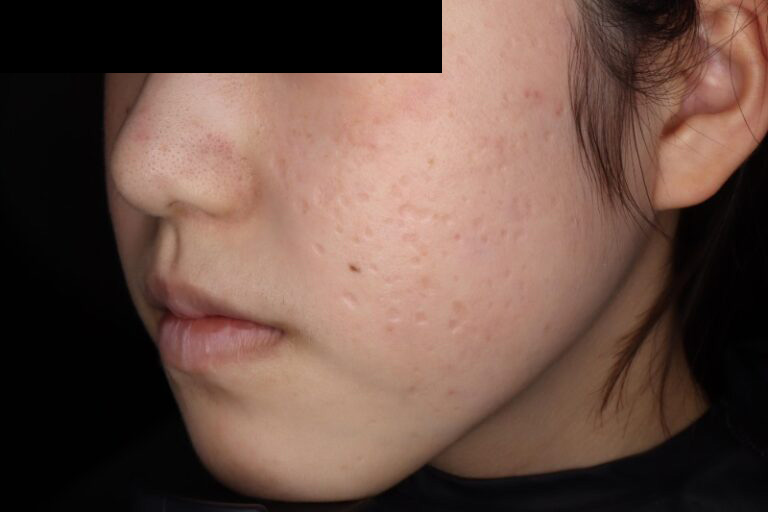 ジュベルック前:横②