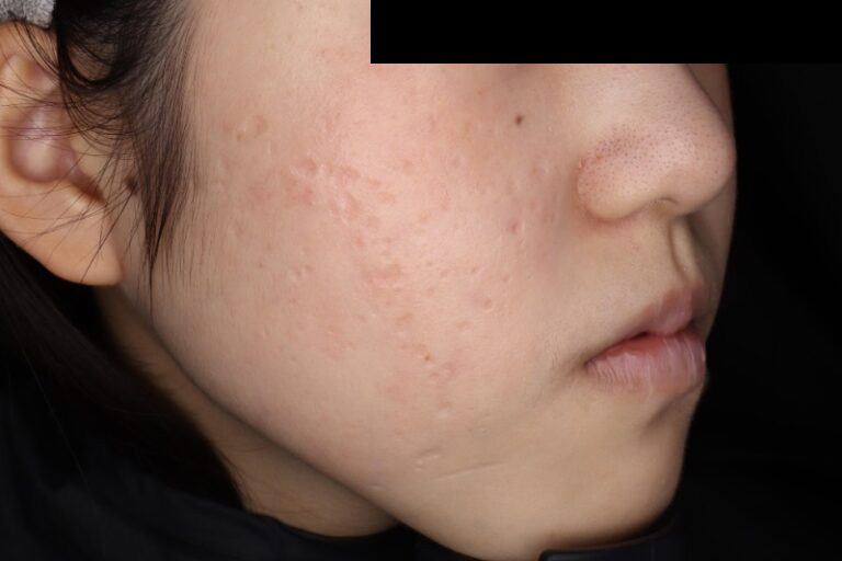 ジュベルック前:横①