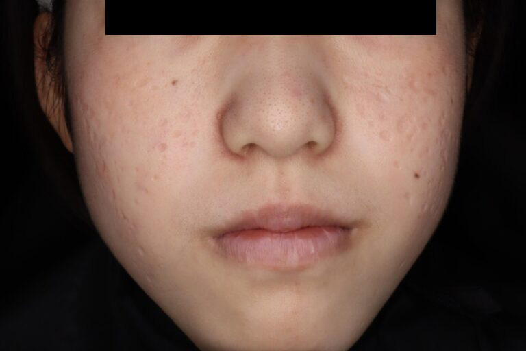 ジュベルック前:正面