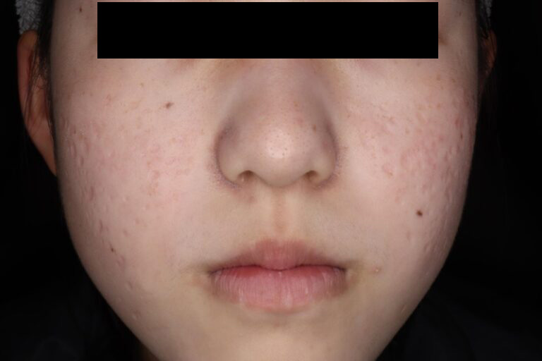 ジュベルック後:正面