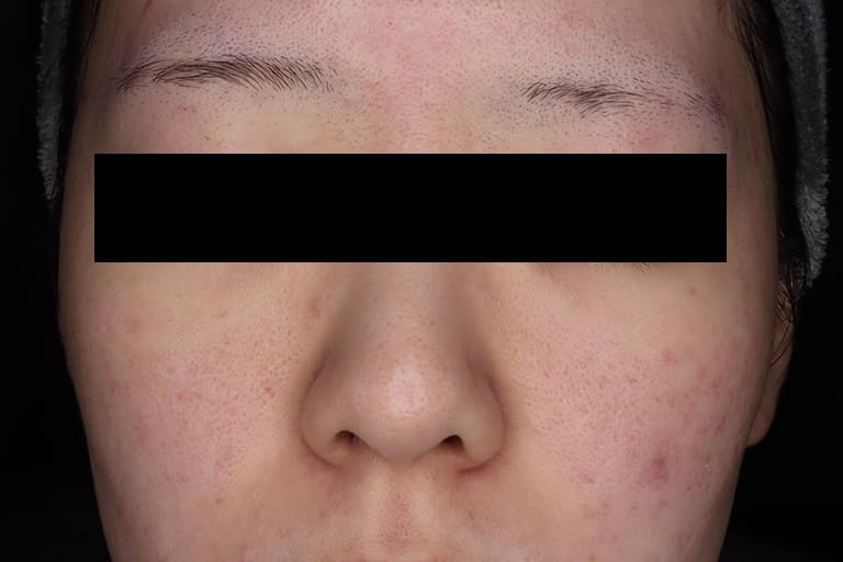 TCAクロス前 正面