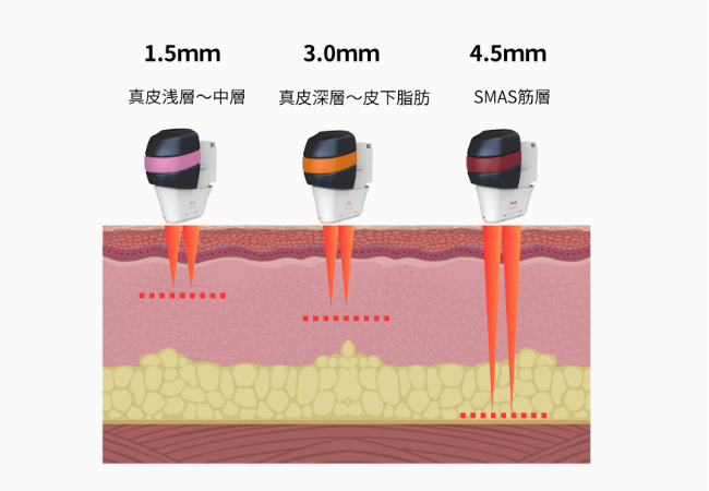 オリジオキス画像