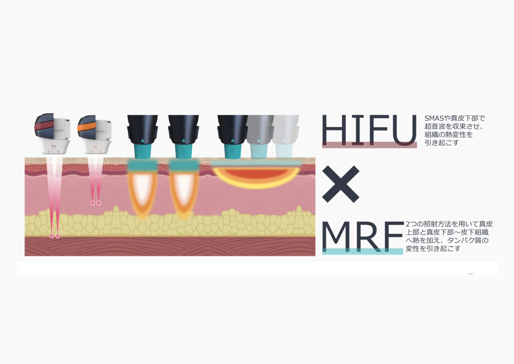 オリジオキス画像