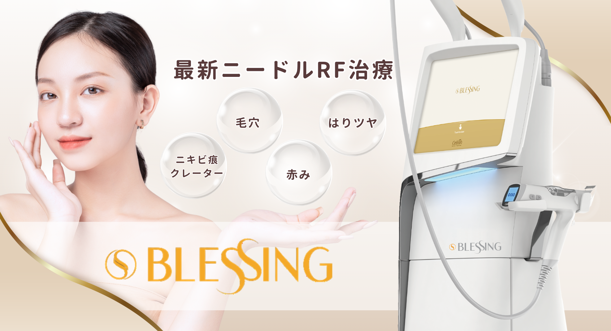 最新ニードルRF治療